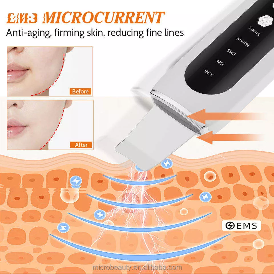 اتو جوانساز صورت مدل Ultrasonic Ion Cleaner