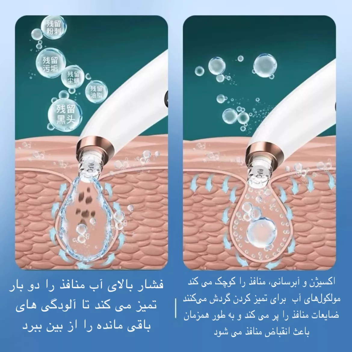 میکرودرم مدل X13