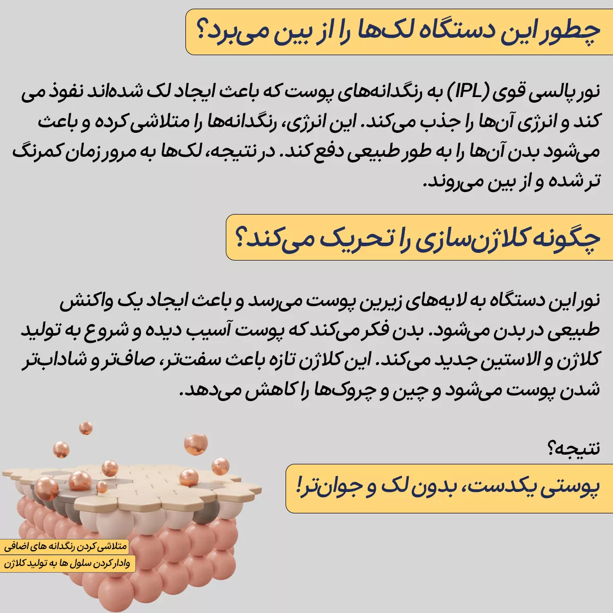 لیزر موهای زائد بدن ولورا مدل CX-883
