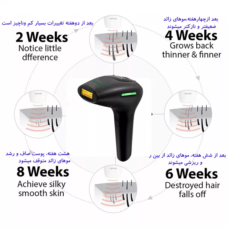 لیزر موهای زائد بانوان ایکسول مدل S-550