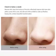 میکرودرم خانگی ول اسکینز مدل  WX-HT100