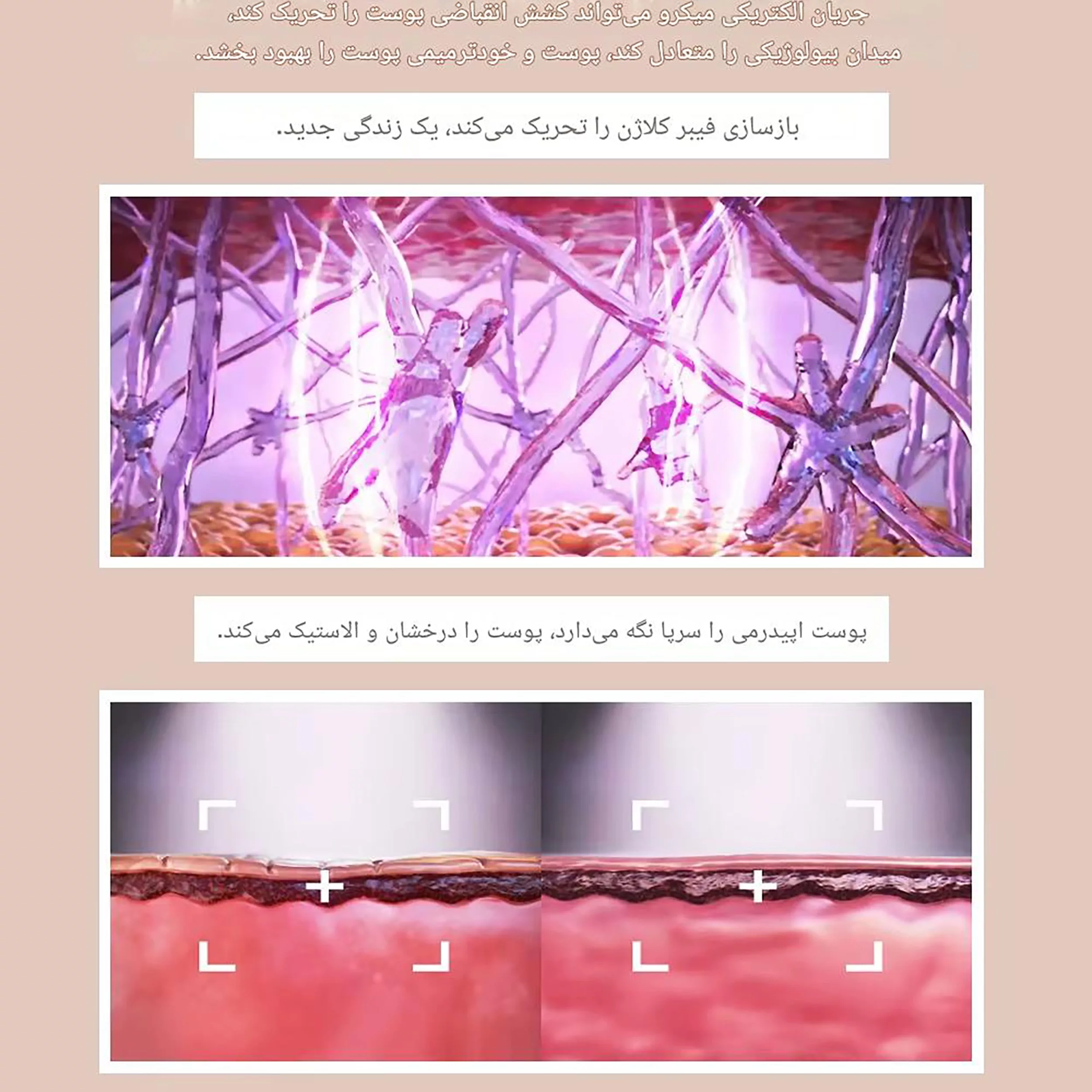 دستگاه لیفت پوست مدل Tightening