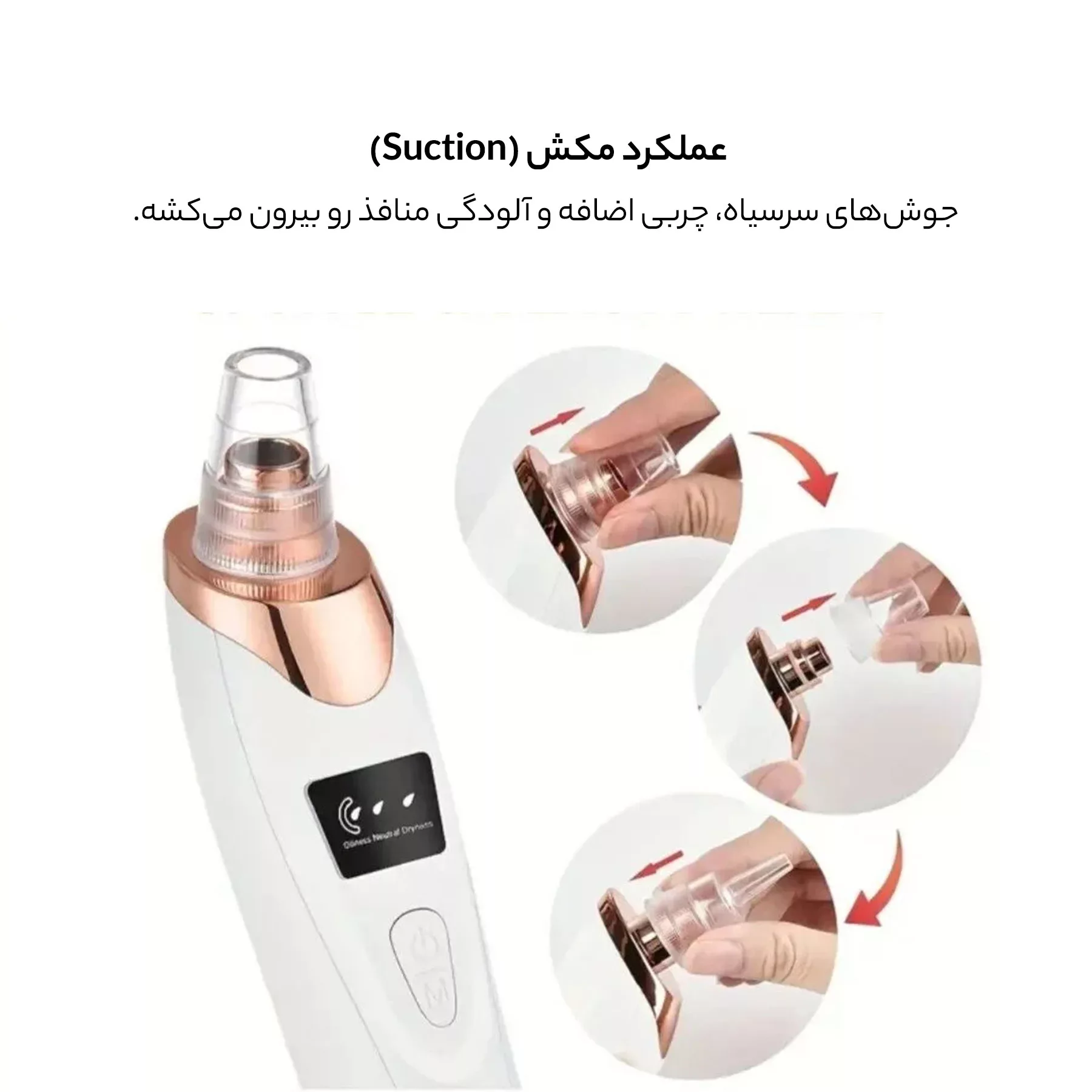 میکرودرم خانگی وینچر مدل Win